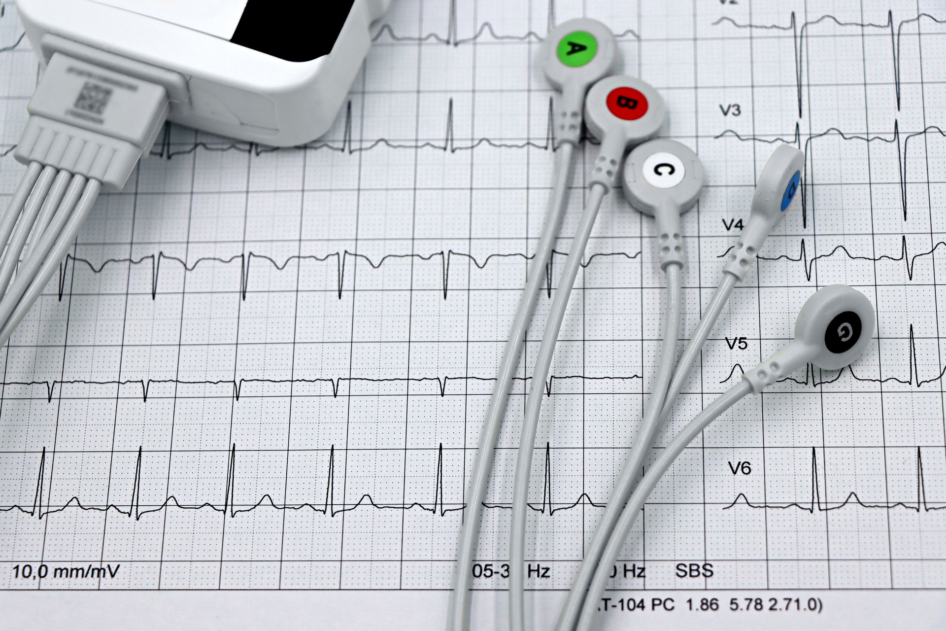 ECG et électrodes
