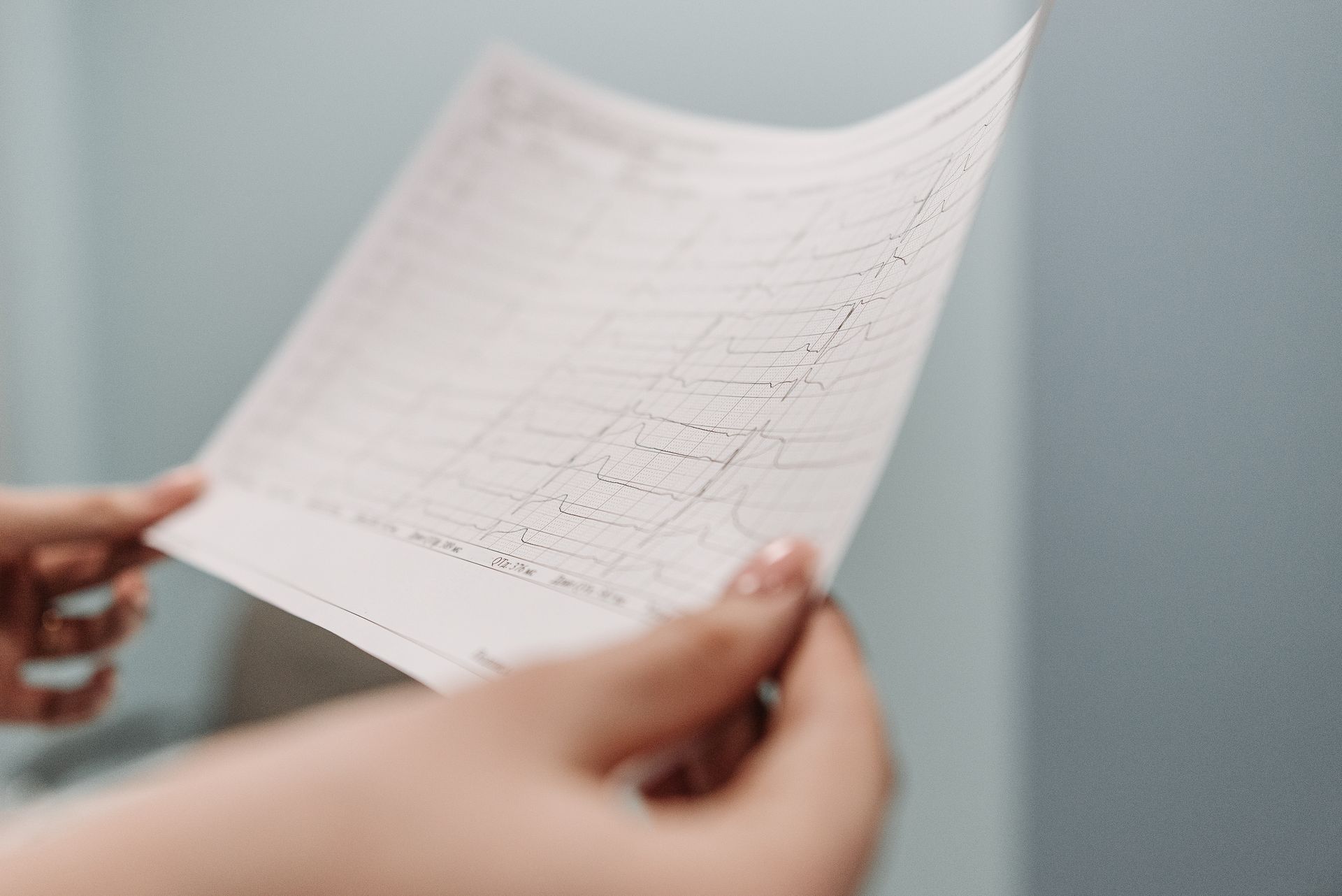 Résultat ECG
